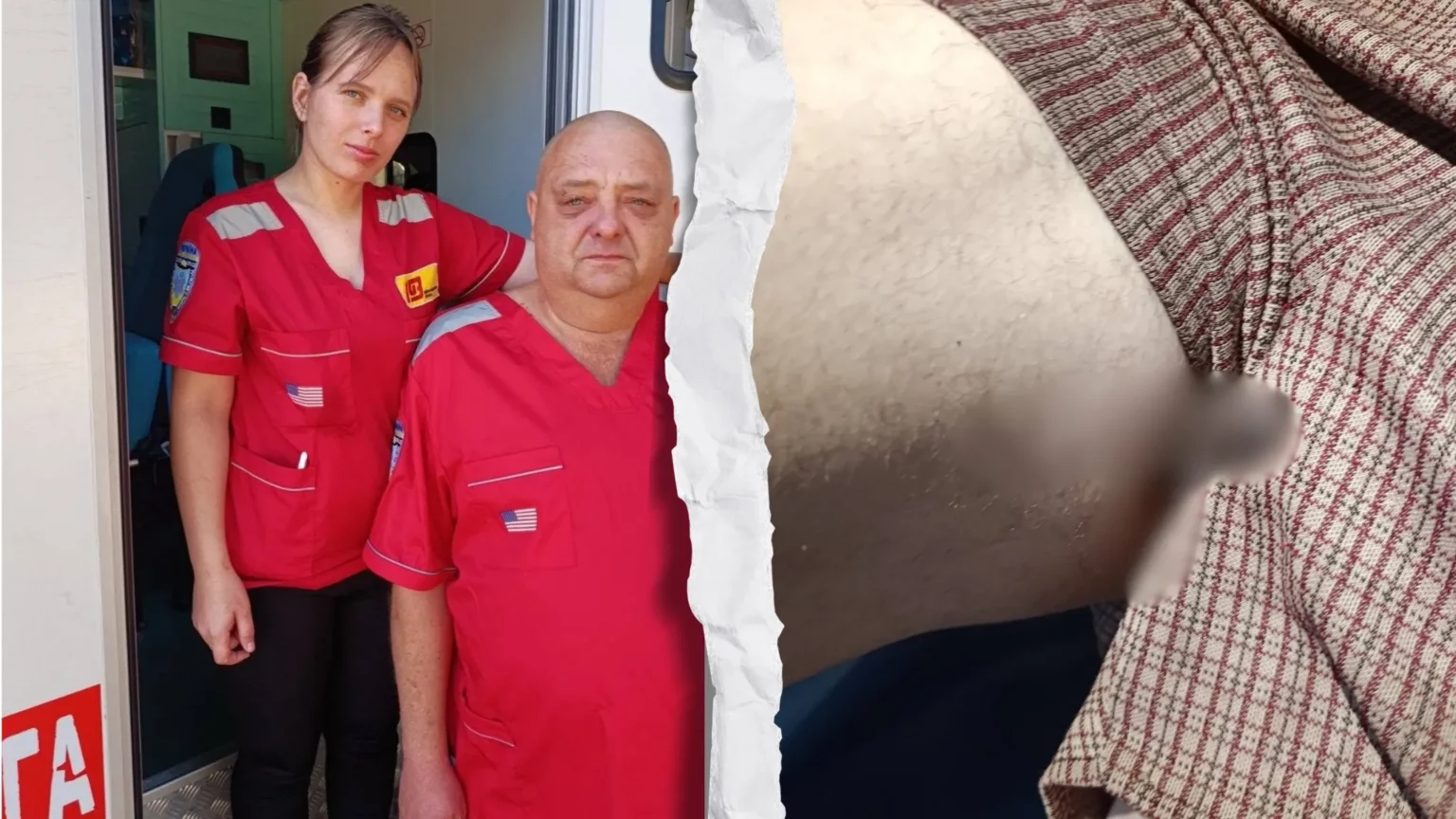 Впав із дерева прямо на арматуру: на Павлоградщині 67-річний чоловік отримав важкі травми